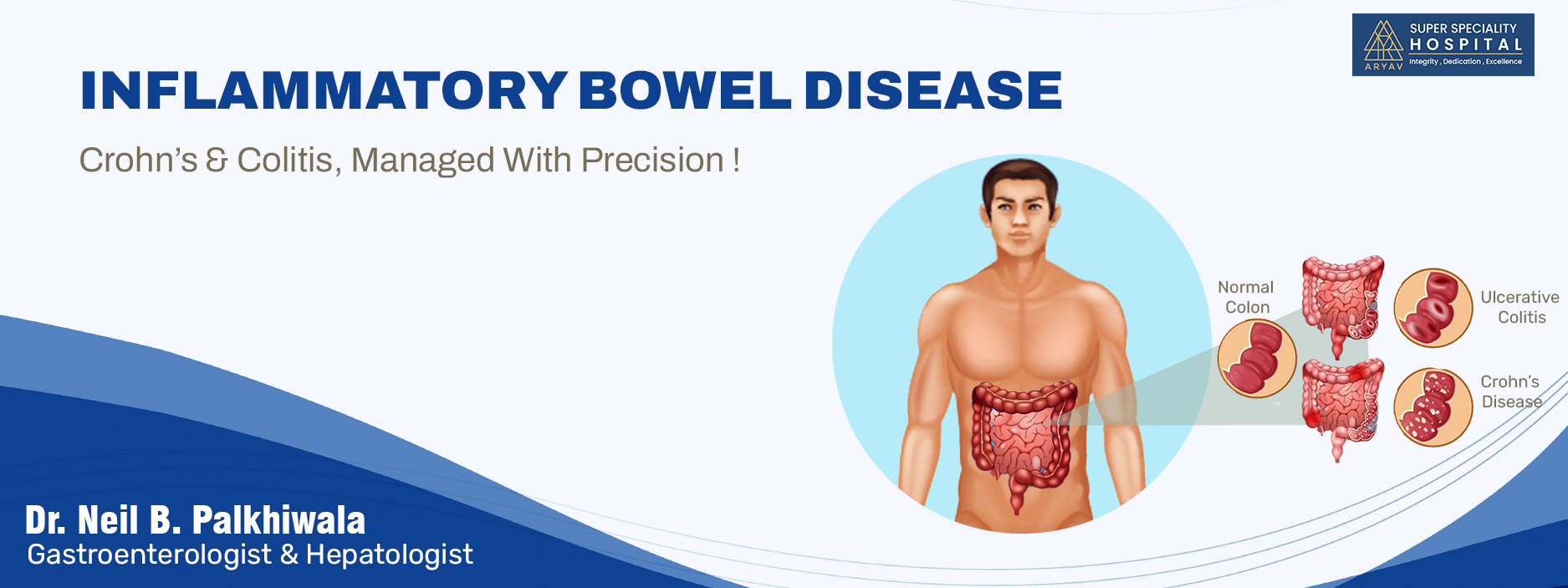 Inflammatory-Bowel-Disease